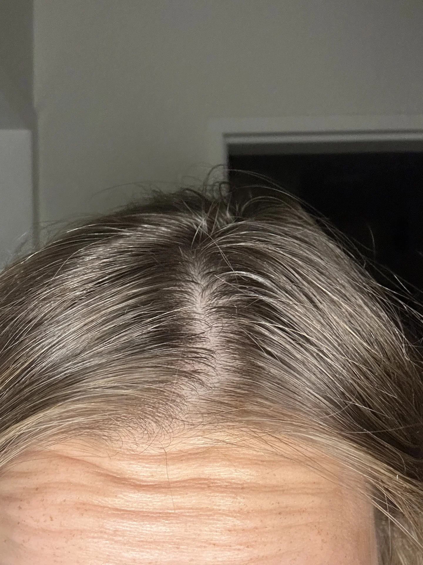 Nicole’s hair part and scalp after serum application